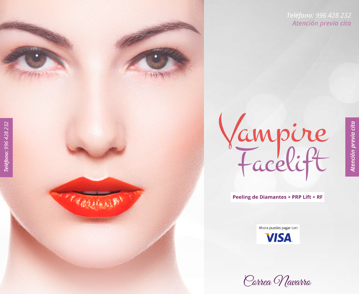 vampire facelift